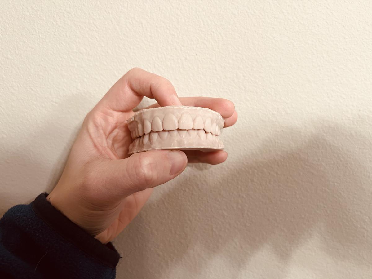 【评测】隐适美 Invisalign